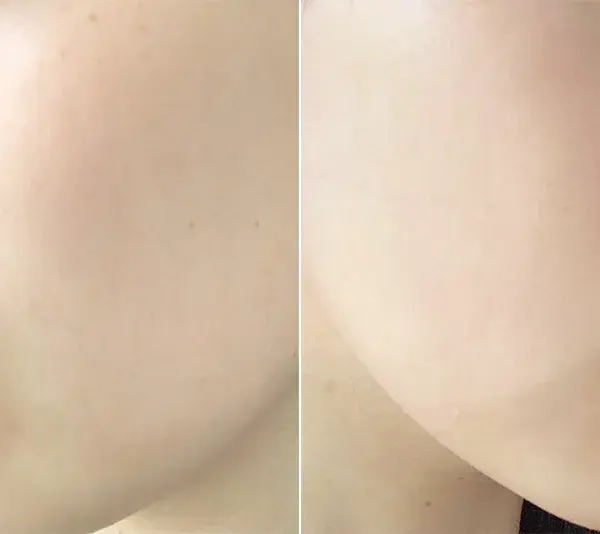 プリマヴィスタの「プリマヴィスタ デイトリートメントバーム」を塗布する前後の肌の比較
